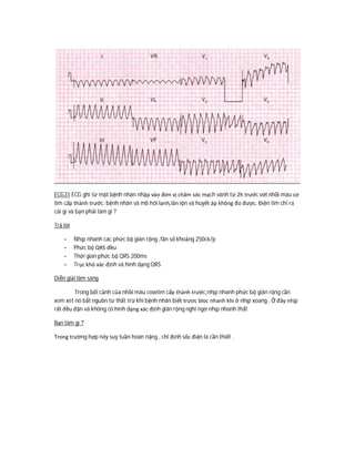 ECG31 ECG ghi từ một bệnh nhân nhập vào đơn vị chăm sóc mạch vành từ 2h trước với nhồi máu cơ
tim cấp thành trước. bệnh nhân vã mồ hôi lạnh,lăn lộn và huyết áp không đo được. Điện tim chỉ ra
cái gì và bạn phải làm gì ?
Trả lời
- Nhịp nhanh các phức bộ giãn rộng ,tần số khoảng 250ck/p
- Phức bộ QRS đều
- Thời gian phức bộ QRS 200ms
- Trục khó xác định và hình dạng QRS
Diễn giải lâm sàng
Trong bối cảnh của nhồi máu cowtim cấp thành trước,nhịp nhanh phức bộ giãn rộng cần
xem xét nó bắt nguồn từ thất trừ khi bệnh nhân biết trươc bloc nhanh khi ở nhịp xoang . Ở đây nhịp
rất đều đặn và không có hình dạng xác định giãn rộng nghi ngờ nhịp nhanh thất
Bạn làm gì ?
Trong trường hợp này suy tuần hoàn nặng , chỉ định sốc điện là cần thiết .
 
