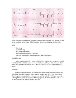 ECG38 : một người đàn ông 60t đến phòng khám dành cho bệnh nhân ngoại trú vì đau ngực khi gắng
sức. Và đây là điện tâm đồ ông ta. ECG chỉ ra cái gì và dấu hiệu thực thể gì bạn có thể tìm thấy.
Trả lời
- Nhịp xoang
- Trục bình thường
- Phức bộ QRS bình thường
- Đoạn ST hơi chênh xuống nhẹ ở DI,DII,AVL
- Đoạn ST ở V4-V6 đi chênh xuống dạng đi ngang hoặc đi chếch xuống
Diễn giải lâm sàng
Những thay đỏi của đoạn ST ở đạo trình DI,DII,AVL là không đặc hiệu , nhưng những thay đổi
ở V4-V5 chắc chắn là do thiếu máu cơ tim vì nó đi chênh xuống là đi ngang và lớn hơn 2mm. Đoạn
ST ở V6 dạng đi chếch xuống có thể là kết quả thiếu máu cơ tim nhưng cũng có thể là kết quả của
digoxin.
Bạn làm gì ?
Không có những dấu hiệu thực thể của thiếu máu cơ tim, nhưng cũng có thể có những dấu
hiệu của đau ( xanh xao, nhịp xoang nhanh), suy tim ( bao gồm tiếng T3,T4 ở mỏm ) hoặc những
bằng chứng của tăng huyết áp, tăng cholesterol máu, hoặc hút thuốc. Có thể không có mạch hoặc
một tiếng thổi ở một động mạch ngoại vi. Một test gắng sức có thể sẽ làm nổi bật hơn thiếu máu cơ
tim nhưng nó không cần thiết cho mục đích chẩn đoán.
 