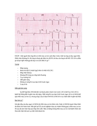 ECG39 : một người đàn ông 65t có nhồi máu cơ tim cách đây 3 năm, hiện tại ông có đau ngực kiểu
thiếu máu khoảng 2h. Khi ông ta được ghi điện tim đồ thì cái đau của ông ta đã hết. ECG chỉ ra điều
gì và bạn nghĩ những gì đã xảy ra và cần điều trị gì ?
Trả lời
- Nhịp xoang
- Block AV độ II ( mobit typ2 nhìn rõ nhất ở DI, DII )
- Nhịp thất 50ck/p
- Khoảng PR trong các nhịp bình thường
- Trục hướng trái
- QRS giãn rộng
- Không có sóng R ở các đạo trình trước ngực
- S sâu ở V6
Diễn giải lâm sàng
Sự kết hợp bloc nhĩ thất độ II và block phân nhánh trái trước ( chỉ ra bởi trục trái ) chỉ ra
bệnh hệ thống dẫn truyền mức độ nặng . Mất sóng R ở các đạo trình trước ngực chỉ ra có thể là kết
quả nhồi máu cơ tim cũ, nhưng sóng S sâu ở đạo trình V6 có thể chỉ ra sự chậm dẫn truyền nội thất.
Bạn làm gì ?
Lần gần đây của đau ngực có thể là do nhồi máu cơ tim thêm nữa, hoặc có thể liên quan nhịp chậm
do block tim hoàn toàn. Nếu ghi lại ECG và xét nghiệm máu các maker không gợi ý nhồi máu cơ tim
thì sau đó cần một máy tạo nhịp vĩnh viễn. Nếu có bằng chứng nhồi máu cơ tim mới bệnh nhân cần
theo dõi chặt chẽ xem sự tiến triển block tim.
 