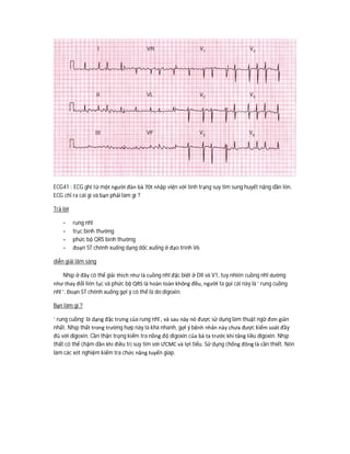 ECG41 : ECG ghi từ một người đàn bà 70t nhập viện với tình trạng suy tim sung huyết nặng dần lên.
ECG chỉ ra cái gì và bạn phải làm gì ?
Trả lời
- rung nhĩ
- trục bình thường
- phức bộ QRS bình thường
- đoạn ST chênh xuống dạng dốc xuống ở đạo trình V6
diễn giải lâm sàng
Nhịp ở đây có thể giải thích như là cuồng nhĩ đặc biệt ở DII và V1, tuy nhiên cuồng nhĩ dường
như thay đổi liên tục và phức bộ QRS là hoàn toàn không đều, người ta gọi cái này là ‘ rung cuồng
nhĩ ‘. Đoạn ST chênh xuống gợi ý có thể là do digoxin.
Bạn làm gì ?
‘ rung cuồng’ là dạng đặc trưng của rung nhĩ , và sau này nó được sử dụng làm thuật ngữ đơn giản
nhất. Nhịp thất trong trường hợp này là khá nhanh, gợi ý bệnh nhân này chưa được kiểm soát đầy
đủ với digoxin. Cần thận trọng kiểm tra nồng độ digoxin của bà ta trước khi tăng liều digoxin. Nhịp
thất có thể chậm dần khi điều trị suy tim với ƯCMC và lợi tiểu. Sử dụng chống đông là cần thiết. Nên
làm các xét nghiệm kiểm tra chức năng tuyến giáp.
 