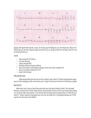 ECG42 :một người đàn ông 50t , ông ta có cái đau ngực khi gắng sức vào vài tháng trước. Ông ta vaò
phòng cấp cứu với tình trạng đau ngực kéo dài liên tục 1h, và đây là điện tim của ông ta. Nó chỉ ra cái
gì và bạn phải làm gì ?
Trả lời
- nhịp xoang tần số 120ck/p
- trục bình thường
- sóng Q nhỏ DIII,AVF
- thời gian QRS bình thường (100ms)
- đoạn ST đi chênh xuống dạng đi ngang ở V3,V4 và đi chếch xuống V5,V6
- đoạn ST đi chênh xuống 5mm ở V3
- sóng T bình thường
diễn giải lâm sàng
Nhịp xoang nhanh phù hợp với cái đau của bệnh nhân. Đoạn ST chênh xuống dạng đi ngang
hay đi chếch xuống gợi ý thiếu máu thành trước. Sóng Q nhỏ ở đạo trình dưới có lẽ không có ý nghĩa.
Bạn làm gì ?
Bệnh nhân này rõ ràng có hội chứng vành cấp ( đau thắt ngực không ổn định). Tiêu sợi huyết
không có chỉ định với ST chênh xuống. Ông ta cần beta block và nitrat ( tĩnh mạch hoặc đường miệng
) và có thể cần dẫn xuất morphin . ECG nên ghi mỗi nửa tiếng một lần để phát hiện sự chênh lên của
đoạn ST . Ông ta cũng cần chụp động mạch vành để can thiệp sớm ( nong bằng bóng qua da ( PTCA)
hay làm cầu nối mạch vành (CBAG))
 
