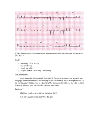 ECG43 : điện tim đồ ghi ở một người phụ nữ 30t phàn nàn về cái hồi hộp trống ngực. Nó giúp gì cho
chẩn đoán ?
Trả lời
- nhịp xoang, tần số 100ck/p
- trục bình thường
- sóng Q nhỏ ở DIII
- các phức bộ khác QRS và sóng T bình thường
Diễn giải lâm sàng
sóng Q ở đạo trình DIII nhưng bình thường ở AVF. Trong tìm các nguyên nhân gây ra hồi hộp
trống ngực thì tiền sử và khám là rất quan trọng, và điện tâm đồ không phải là thường xuyên hữu ích
trừ khi nó được ghi khi bệnh nhân có triệu chứng. Một nhịp xoang nhanh liên tục như ở đây có thể là
do lo lắng, nhiễm độc giáp, mất máu cấp, thiếu máu hoặc suy tim
Bạn làm gì ?
Điều trị các nguyên nhân cơ bản của nhịp xoang nhanh.
Bệnh nhân này đã kiểm tra và có nhiễm độc giáp.
 