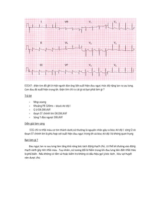 ECG47 : điện tim đồ ghi ở một người đàn ông 50t xuất hiện đau ngực mức độ nặng lan ra sau lưng.
Cơn đau đã xuất hiện trong 6h. Điện tim chỉ ra cái gì và bạn phải làm gì ?
Trả lời
- Nhịp xoang
- Khoảng PR 320ms – block AV độ I
- Q ở DII,DIII,AVF
- Đoạn ST chênh lên DII,DIII,AVF
- Sóng T đảo ngược DIII,AVF
Diễn giải lâm sàng
ECG chỉ ra nhồi máu cơ tim thành dưới,nó thường là nguyên nhân gây ra bloc AV độ I. sóng Q và
Đoạn ST chênh lên là phù hợp với xuất hiện đau ngực trong 6h và bloc AV độ I là không quan trọng
Bạn làm gì ?
Đau ngực lan ra sau lưng làm tăng khả năng bóc tách động mạch chủ, có thể bít đường vào động
mạch vành gây nên nhồi máu . Tuy nhiên ,nó tương đối là hiếm trong khi đau lưng liên đến nhồi máu
là phổ biến . Nếu không có tiền sử hoặc kiểm tra không có dấu hiệu gợi ý bóc tách , tiêu sợi huyết
nên được cho.
 