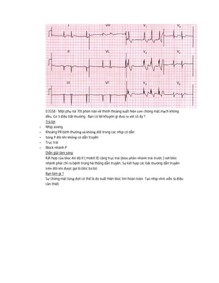 ECG58 : Một phụ nữ 70t phàn nàn về thỉnh thoảng xuất hiện cơn chóng mặt,mạch không
đều. Có 3 điều bất thường . Bạn có lời khuyên gì đưa ra với cô ấy ?
Trả lời
- Nhịp xoang
- Khoảng PR bình thường và không đổi trong các nhịp có dẫn
- Sóng P đôi khi không có dẫn truyền
- Trục trái
- Block nhánh P
Diễn giải lâm sàng
Kết hợp của bloc AV độ II ( mobit II) cộng trục trái (bloc phân nhánh trái trước ) với bloc
nhánh phải chỉ ra bệnh trong hệ thống dẫn truyền. Sự kết hợp các bất thường dẫn truyền
trên đôi khi được gọi là bloc ba bó.
Bạn làm gì ?
Sự chóng mặt từng đợt có thể là do xuất hiện bloc tim hoàn toàn. Tạo nhịp vĩnh viễn là điều
cần thiết.
 