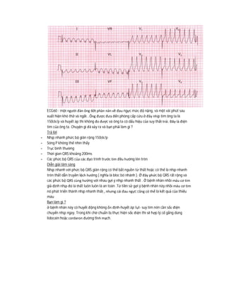 ECG60 : một người đàn ông 60t phàn nàn về đau ngực mức độ nặng, và một vài phút sau
xuất hiện khó thở và ngất . Ông được đưa đến phòng cấp cứu ở đây nhịp tim ông ta là
150ck/p và huyết áp thì không đo được và ông ta có dấu hiệu của suy thất trái. Đây là điện
tim của ông ta. Chuyện gì đã xảy ra và bạn phải làm gì ?
Trả lời
- Nhịp nhanh phức bộ giãn rộng 150ck/p
- Sóng P không thể nhìn thấy
- Trục bình thường
- Thời gian QRS khoảng 200ms
- Các phức bộ QRS của các đạo trình trước tim đều hướng lên trên
Diễn giải lâm sàng
Nhịp nhanh với phức bộ QRS giãn rộng có thể bắt nguồn từ thất hoặc có thể là nhịp nhanh
trên thất dẫn truyền lệch hướng ( nghĩa là bloc bó nhánh ). Ở đây phức bộ QRS rất rộng và
các phức bộ QRS cùng hướng với nhau gợi ý nhịp nhanh thất . Ở bệnh nhân nhồi máu cơ tim
giả định nhịp đó là thất luôn luôn là an toàn .Từ tiền sử gợi ý bệnh nhân này nhồi máu cơ tim
nó phát triển thành nhịp nhanh thất , nhưng cái đau ngực cũng có thể là kết quả của thiếu
máu
Bạn làm gì ?
ở bệnh nhân này có huyết động không ổn định-huyết áp tụt- suy tim nên cần sốc điện
chuyển nhịp ngay. Trong khi chờ chuẩn bị thực hiện sốc điện thì sẽ hợp lý cố gắng dùng
lidocain hoặc cordaron đường tĩnh mạch.
 