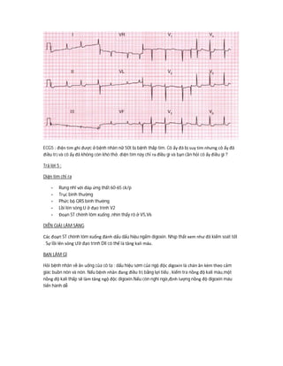 ECG5 : điện tim ghi được ở bệnh nhân nữ 50t bị bệnh thấp tim. Cô ấy đã bị suy tim nhưng cô ấy đã
điều trị và cô ấy đã không còn khó thở. điện tim này chỉ ra điều gì và bạn cần hỏi cô ấy điều gì ?
Trả lời 5 :
Diện tim chỉ ra
- Rung nhĩ với đáp ứng thất 60-65 ck/p
- Trục bình thường
- Phức bộ QRS bình thường
- Lồi lên sóng U ở đạo trình V2
- Đoạn ST chênh lõm xuống ,nhìn thấy rõ ở V5,V6
DIỄN GIẢI LÂM SÀNG
Các đoạn ST chênh lõm xuống đánh dấu dấu hiệu ngấm digoxin. Nhịp thất xem như đã kiểm soát tốt
. Sự lồi lên sóng Ưở đạo trình DII có thể là tăng kali máu.
BẠN LÀM GÌ
Hỏi bệnh nhân về ăn uống của cô ta : dấu hiệu sớm của ngộ độc digoxin là chán ăn kèm theo cảm
giác buồn nôn và nôn. Nếu bệnh nhân đang điều trị bằng lợi tiểu , kiểm tra nồng độ kali máu,một
nồng độ kali thấp sẽ làm tăng ngộ độc digoxin.Nếu còn nghi ngờ,định lượng nồng độ digoxin máu
tiến hành dễ
 