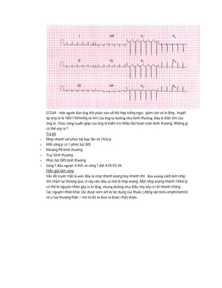 ECG64 : một người đàn ông 45t phàn nàn về hồi hộp trống ngực, giảm cân và lo lắng . huyết
áp ông ta là 180/110mmhg và tim của ông ta dường như bình thường. Đây là điện tim của
ông ta. Chức năng tuyến giáp của ông ta kiểm tra nhiều lần hoàn toàn bình thường. Những gì
có thể xảy ra ?
Trả lời
- Nhịp nhanh với phức bộ hẹp tần số 14ck/p
- Mỗi sóng p có 1 phức bộ QRS
- Khoảng PR bình thường
- Trục bình thường
- Phức bộ QRS bình thường
- Sóng T đảo ngược ở AVL và sóng T dẹt ở DI,V5-V6
Diễn giải lâm sàng
Vấn đề trước mắt là xem đây là nhịp nhanh xoang hay nhanh nhĩ . Xoa xoang cảnh làm nhịp
tim chậm lại thoáng qua, vì vậy nên đây có thể là nhịp xoang. Một nhịp xoang nhanh 140ck/p
có thể là nguyên nhân gây ra lo lắng, nhưng dường như điều này xảy ra rất nhanh chóng .
Các nguyên nhân khác cần được xem xét là tác dụng của thuốc ( đồng vận beta,amphetamin)
và u tủy thượng thận – mà từ đó ta đưa ra được chẩn đoán.
 