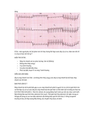 dàng
ECG6 : một người phụ nữ 26t phàn nàn về triệu chứng hồi hộp trước đây của cô ta. Điện tâm đồ chỉ
ra cái gì và bạn cần làm gì ?
ĐIỆN TIM CHỈ RA :
- Nhịp tim nhanh với các phức bộ hẹp ,tần số 200ck/p
- Không nhìn thấy sóng p
- Trục bình thường
- Các phức bộ QRS đều nhau
- Phức bộ QRS, đoạn ST và sóng T bình thường
DIỄN GIẢI LÂM SÀNG
đây là nhịp nhanh trên thất , và không nhìn thấy sóng p nên đây là nhịp nhanh bộ nối hoặc nhịp
nhanh nút nhĩ thất.
BẠN PHẢI LÀM GÌ ?
Nhịp nhanh bộ nối là phổ biến gây ra cơn nhịp nhanh kịch phát ở người trẻ và có lẽ nó giải thích cho
cái hồi hộp của cô ta trước đây.khi nhịp nhanh bộ nối xuất hiện có thể chấm dứt nó bằng vài thao tác
kích thích thần kinh phế vị : thao tác valsava ,ấn xoang động mạch cảnh,úp măt vào chậu nước lạnh.
Nếu không hiệu quả tiêm blus adenosin tĩnh mạch. Thời gian bán hủy adenosin rất ngắn nhưng có
thể gây đỏ bừng và cơn hen.Nếu adenosin vẫn không hiệu quả thì tiêm blus 5-10mg verapamil
thường sẽ đưa về nhịp xoang.Nếu không, sốc chuyển nhịp đươc chỉ định.
 