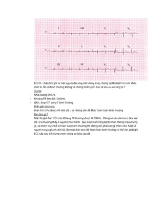ECG75 : điện tim ghi từ một người đàn ông 45t không triệu chứng tại lần kiểm tra sức khỏe
định kì. Nó có bình thường không và những lời khuyên bạn sẽ đưa ra với ông ta ?
Trả lời
- Nhịp xoang 64ck/p
- Khoảng PR kéo dài ( 360ms)
- QRS , đoạn ST, sóng T bình thường
Diễn giải lâm sàng
Điện tim chỉ ra bloc nhĩ thất độ I, và những vấn đề khác hoàn toàn bình thường
Bạn làm gì ?
Mặc dù giới hạn trên của khoảng PR thường được là 200ms , thời gian kéo dài hơn ( bloc AV
độ I ) là thường thấy ở người khỏe mạnh . Bạn được biết rằng bệnh nhân không triệu chứng
gì, và khám thực thể là hoàn toàn bình thường thì không cần phải làm gì thêm nữa. Một số
người trong nghành đòi hỏi cần một điện tâm đồ hoàn toàn bình thường có thể cần phải ghi
ECG cấp cứu để chứng minh không có bloc cao độ .
 