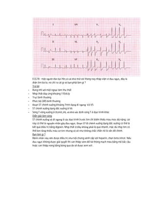 ECG78 : một người đàn bà 70t có cái khó thở vài tháng nay,nhập viện vì đau ngực, đây là
điện tim bà ta, nó chỉ ra cái gì và bạn phải làm gì ?
Trả lời
- Rung nhĩ với một ngoại tâm thu thất
- Nhịp thất đáp ứng khoảng 110ck/p
- Trục bình thường
- Phức bộ QRS bình thường
- Đoạn ST chênh xuống khoảng 7mm dạng đi ngang V2-V5
- ST chênh xuống dạng dốc xuống ở V6
- Sóng T võng xuống ở DI,AVL,V6, và khó xác định sóng T ở đạo trình khác
Diễn giải lâm sàng
ST chênh xuống và đi ngang ở các đạo trình trước tim chỉ điểm thiếu máu mức độ nặng, cái
này có thể là nguyên nhân gây đau ngực. Đoạn ST đi chênh xuống dạng dốc xuống có thể là
kết quả điều trị bằng digoxin. Nhịp thất ở đây không phải là quá nhanh, mặc dù nhịp tim có
thể làm tăng thiếu máu cơ tim nhưng có vẻ như không chắc chắn nó là vấn đề chính.
Bạn làm gì ?
Bệnh nhân này nên được điều trị như hội chứng vành cấp với heparin, chẹn beta,nitrat. Nếu
đau ngực không được giải quyết thì can thiệp sớm để tái thông mạch máu bằng mổ bắc cầu
hoặc can thiệp nong bằng bóng qua da sẽ được xem xét .
 