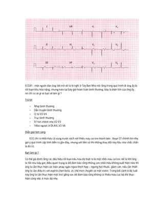 ECG81 : một người đàn ông 50t trở về từ kì nghỉ ở Tây Ban Nha nói rằng trong quá trình đi ông ấy bị
rối loạn tiêu hóa nặng, nhưng hiên tại bây giờ hoàn toàn bình thường. Đây là điện tim của ông ấy :
nó chỉ ra cái gì và bạn sẽ làm gì ?
Trả lời
- Nhịp bình thường
- Dẫn truyền bình thường
- Q từ V2-V4
- Trục bình thường
- ST hơi chênh nhẹ V2-V3
- Tđảo ngược ở DI,AVL,V2-V6
Diễn giải lâm sàng
ECG chỉ ra nhồi máu cũ vùng trước vách với thiếu máu cơ tim thành bên . Đoạn ST chênh lên nhẹ
gợi ý quá trình cấp tính diễn ra gần đây, nhưng với tiền sử thì những thay đổi này hầu như chắc chắn
là đã cũ.
Bạn làm gì ?
Có thể giả định rằng các dấu hiệu rối loạn tiêu hóa đó thật ra là một nhồi máu cơ tim. Kể từ khi ông
ta tốt như bây giờ, điều quan trọng là để đảm bảo rằng những cơn nhồi máu không xuất hiện nữa thì
ông ta cần thực hiện các biện pháp ngăn ngừa thích hợp – ngừng hút thuốc, giảm cân, nếu cần thiết
ông ta cần điều trị với aspirin,chẹn beta, ức chế men chuyển và một statin. Trong bối cảnh ở độ tuổi
này ông ta cần thực hiện một test gắng sức để đảm bảo rằng không có thiếu máu cuc bộ khi thực
hiện công việc ở mức độ nhẹ.
 