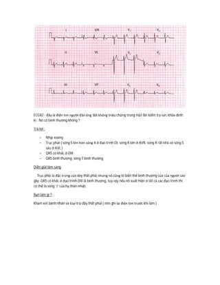 ECG82 : đây là điện tim người đàn ông 30t không triệu chứng trong một lần kiểm tra sức khỏe định
kì . Nó có bình thường không ?
Trả lời :
- Nhịp xoang
- Trục phải ( sóng S lớn hơn sóng R ở đạo trình DI, sóng R lớn ở AVR, sóng R rất nhỏ và sóng S
sâu ở AVL )
- QRS có khấc ở DIII
- QRS bình thường, sóng T bình thường
Diễn giải lâm sàng
Trục phải là đặc trưng của dày thất phải nhưng nó cũng là biến thể bình thường của của người cao
gầy. QRS có khấc ở đạo trình DIII là bình thường, tuy vậy nếu nó xuất hiện ở tất cả các đạo trình thì
có thể là sóng ‘J’ của hạ thân nhiệt.
Bạn làm gì ?
Khám xét bệnh nhân và loại trừ dầy thất phải ( nên ghi lại điện tim trước khi làm )
 