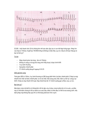 ECG85 : một thanh niên 25t bị thông liên nhĩ vào viện cấp cứu vì cơn hồi hộp trống ngực. Nhịp tim
của ông ta 170ck/p ,huyết áp 140/80mmhg và không có dấu hiệu suy tim. Đây là rối loạn nhịp gì và
bạn sẽ làm gì ?
Trả lời
- Nhịp nhanh phức bộ rộng , tần số 170ck/p
- Không rõ sóng p nhưng khả năng nhìn thấy được ở đạo trình AVR
- Trục bình thường
- Dạng bloc nhánh phải
- ST chênh xuống dạng đi ngang ở V4,V5
Diễn giải lâm sàng
Thời gian QRS là 120ms, trục bình thường và QRS dạng điển hình của bloc nhánh phải. Ở đây là nhịp
nhanh trên thất với bloc nhánh phải, và nó sẽ chắc chắn đúng nếu chắc chắn sự tồn tại sóng p tại
AVR. Ở đây là nhịp nhanh nhĩ hoặc nhịp nhanh bộ nối. ST chênh xuống gợi ý thiếu máu cơ tim.
Bạn làm gì ?
Nếu bệnh nhân đã biết là có thông liên nhĩ thì gần như là bloc nhánh phải đã có từ trước, và điều
này có thể kiểm chứng từ hồ sơ bệnh án trước đây. Điều trị khởi đầu có thể là xoa xoang cảnh, nếu
biện pháp này không hiệu quả thì có thể dùng adenosin tĩnh mạch.
 