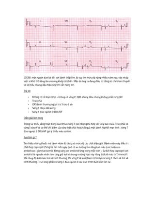 ECG88 :một người đàn bà 65t với bệnh thấp tim, bị suy tim mức độ nặng nhiều năm nay, vào nhập
viện vì khó thở tăng lên và sưng khớp cổ chân. Mặc dù ông ta đang điều trị bằng ức chế men chuyển
và lợi tiểu nhưng dấu hiệu suy tim vẫn nặng lên.
Trả lời
- Không rõ rối loạn nhịp – không có sóng P, QRS không đều nhưng không phải rung nhĩ
- Trục phải
- QRS bình thường ngoại trừ S sâu ở V6
- Sóng T nhọn đối xứng
- Sóng T đảo ngược ở DIII,AVF
Diễn giải lâm sàng
Trong sự thiếu vắng hoạt động của nhĩ và sóng T cao nhọn phù hợp với tăng kali máu. Trục phải và
sóng S sâu ở V6 có thể chỉ điểm của dày thất phải hoặc kết quả một bệnh lý phổi mạn tính . sóng T
đảo ngược ở DIII,AVF gợi ý thiếu máu cơ tim.
Bạn làm gì ?
Tìm hiểu những thuốc mà bệnh nhân đã dùng và mức độ các chất điện giải. Bệnh nhân này điều trị
phối hợp captopril 25mg ba lần mỗi ngày ( nó có xu hướng làm tăng kali máu ) và 3 viên co-
amilofruse ( gồm furosemid 40mg cộng với amilorid 5mg trong mỗi viên ). Sự kết hợp captopril với
amiolrid là nguyên nhân làm tăng giữ kali và trong trường hợp này nồng độ kali máu là 7,4mmol/l.
Khi nồng độ kali máu trở về bình thường, thì sóng P sẽ xuất hiện rõ trở lại và sóng T nhon sẽ trở về
bình thường. Trục xoay phải và sóng T đảo ngược ở các đạo trình dưới vẫn tồn tại .
 