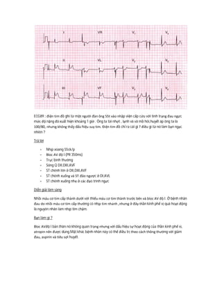 ECG89 : điện tim đồ ghi từ một người đàn ông 55t vào nhập viện cấp cứu với tình trạng đau ngực
mức độ nặng đã xuất hiện khoảng 1 giờ . Ông ta tái nhợt , lạnh và vã mồ hôi,huyết áp ông ta là
100/80, nhưng không thấy dấu hiệu suy tim. Điện tim đồ chỉ ra cái gì ? điều gì từ nó làm bạn ngạc
nhiên ?
Trả lời
- Nhịp xoang 55ck/p
- Bloc AV độ I (PR 350ms)
- Trục bình thường
- Sóng Q DII,DIII,AVF
- ST chênh lên ở DII,DIII,AVF
- ST chênh xuống và ST đảo ngược ở DI,AVL
- ST chênh xuống nhẹ ở các đạo trình ngực
Diễn giải lâm sàng
Nhồi máu cơ tim cấp thành dưới với thiếu máu cơ tim thành trước bên và bloc AV độ I. Ở bệnh nhân
đau do nhồi máu cơ tim cấp thường có nhịp tim nhanh ,nhưng ở đây thần kinh phế vị quá hoạt động
là nguyên nhân làm nhịp tim chậm.
Bạn làm gì ?
Bloc AVđộ I bản thân nó không quan trọng nhưng với dấu hiệu sự hoạt động của thần kinh phế vị,
atropin nên được dùng.Mặt khác bệnh nhân này có thể điều trị theo cách thông thường với giảm
đau, aspirin và tiêu sợi huyết.
 