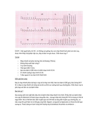 ECG91 : một người phụ nữ 35t , có những cơn giống như cơn nhịp nhanh kịch phát vài năm nay,
được nhìn thấy ở bộ phận cấp cứu, đây là điện tim ghi được. Chẩn đoán là gì ?
Trả lời
- Nhịp nhanh với phức bộ hẹp tần số khoảng 170ck/p
- Không thấy xuất hiện sóng P
- Trục bình thường
- Thời gian QRS 112ms
- Nét trát đậm ở QRS nhìn rõ nhất ở đạo trình V3,V4
- ST chênh xuống ở đạo trình V3-V6
- T đảo ngược ở các đạo trình thành bên
Diễn giải lâm sàng
Đây là nhịp nhanh phức bộ hẹp vì vậy nó là nhịp trên thất. Nét trát đậm ở QRS gợi ý hội chứng W-P-
W, vì đây là nhịp nhanh với vòng vào lại do sự khử cực xuống dưới qua đường phụ. Chẩn đoán này là
phù hợp với tiền sử của bệnh nhân.
Bạn làm gì ?
Xoa xoang cảnh nên nghĩ đến đầu tiên ở bệnh nhân nhịp nhanh trên thất. Ở hầu hết các bệnh nhân
như vậy thì Adenosin là thuốc được dùng đầu tiên , nhưng ở đây hội chứng W-P-W sử dụng có thể sẽ
nguy hiểm. Nó có thể làm bloc dẫn truyền qua nút nhĩ thất và tăng dẫn truyền qua đường phụ, và
nếu rung nhĩ xuất hiện nó có thể gây rung thất. Digoxin ,verapamil và lignocaine có theercho kết quả
tương tự. Thuốc dùng an toàn trong tình huống này là betablock,flecainide và amidaron .
 