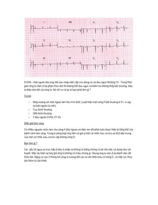 ECG96 : một người đàn ông 50t vào nhập viện cấp cứu đang có cái đau ngực khoảng 1h. Trong thời
gian ông ta nằm ở bộ phận theo dõi thì không hết đau ngực và kiểm tra không thấy bất thường. Đây
là điện tâm đồ của ông ta. Nó chỉ ra cái gì và bạn phải làm gì ?
Trả lời
- Nhịp xoang với một ngoại tâm thu trên thất ( xuất hiện một sóng P bất thường ở V1, vì vậy
nó bắt nguồn từ nhĩ )
- Trục bình thường
- QRS bình thường
- T đảo ngược ở AVL,V1-V6
Diễn giải lâm sàng
Có nhiều nguyên nhân làm cho sóng P đảo ngược và điện tim đồ phải luôn được hiểu là tổng thể của
bệnh cảnh lâm sàng. Trong trường hợp này tiền sử gợi ý một cái nhồi máu cơ tim và ECG đặc trưng
của một cái nhồi máu cơ tim cấp không sóng Q.
Bạn làm gì ?
Các yếu tố nguy cơ trực tiếp ở đây là thấp và không có bằng chứng có lợi cho việc sử dụng tiêu sợi
huyết. Mặc dù hiện tại bây giờ ông ta không có triệu chứng gì nhưng ông ta nên ở lại bệnh viện để
theo dõi. Nguy cơ sau 3 tháng tới cũng là tương đối cao so với nhồi máu có sóng Q , và tiếp tục theo
dõi thêm là cần thiết.
 