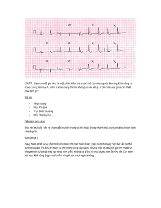 ECG97 : điện tâm đồ ghi như là một phần kiểm tra trước mổ của một người đàn ông 65t không có
triệu chứng tim mạch, kiểm tra lâm sàng thì tim không có vấn đề gì . ECG chỉ ra cái gì và cần thiết
phải làm gì ?
Trả lời
- Nhịp xoang
- Bloc AV độ I
- Trục bình thường
- Bloc nhánh phải
Diễn giải lâm sàng
Bloc nhĩ thất độ I chỉ ra chậm dẫn truyền trong bó his hoặc trong nhánh trái, cộng với bloc hoàn toàn
nhánh phải.
Bạn làm gì ?
Nguy hiểm nhất là sự phát triển lên bloc nhĩ thất hoàn toàn, mặc dù tình trạng hiện tại vẫn có thể
duy trì lâu dài. Về điều trị hiện tại thì không có gì cấp bách, nhưng một số chuyên gia tim mạch sẽ
khuyên nên cấy một máy tạo nhịp vĩnh viễn. Không có điều trị khác được xem là hữu ích. Cần xem
xét xem khả năng ông ta có khiếm khuyết các vách ngăn không .
 