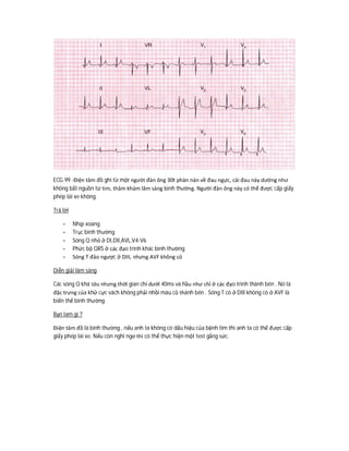 ECG 99 :Điện tâm đồ ghi từ một người đàn ông 30t phàn nàn về đau ngực, cái đau này dường như
không bắt nguồn từ tim, thăm khám lâm sàng bình thường. Người đàn ông này có thể được cấp giấy
phép lái xe không.
Trả lời
- Nhịp xoang
- Trục bình thường
- Sóng Q nhỏ ở DI,DII,AVL,V4-V6
- Phức bộ QRS ở các đạo trình khác bình thường
- Sóng T đảo ngược ở DIII, nhưng AVF không có
Diễn giải lâm sàng
Các sóng Q khá sâu nhưng thời gian chỉ dưới 40ms và hầu như chỉ ở các đạo trình thành bên . Nó là
đặc trưng của khử cực vách không phải nhồi máu cũ thành bên . Sóng T có ở DIII không có ở AVF là
biến thể bình thường.
Bạn lam gì ?
Điện tâm đồ là bình thường , nếu anh ta không có dấu hiệu của bệnh tim thì anh ta có thể được cấp
giấy phép lái xe. Nếu còn nghi ngơ thì có thể thực hiện một test gắng sức.
 