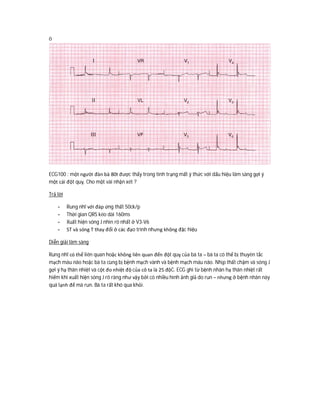 ô
ECG100 : một người đàn bà 80t được thấy trong tình trạng mất ý thức với dấu hiệu lâm sàng gợi ý
một cái đột quỵ. Cho một vài nhận xét ?
Trả lời
- Rung nhĩ với đáp ứng thất 50ck/p
- Thời gian QRS kéo dài 160ms
- Xuất hiện sóng J nhìn rõ nhất ở V3-V6
- ST và sóng T thay đổi ở các đạo trình nhưng không đặc hiệu
Diễn giải lâm sàng
Rung nhĩ có thể liên quan hoặc không liên quan đến đột quỵ của bà ta – bà ta có thể bị thuyên tắc
mạch máu não hoặc bà ta cùng bị bệnh mạch vành và bệnh mạch máu não. Nhịp thất chậm và sóng J
gợi ý hạ thân nhiệt và cột đo nhiệt độ của cô ta là 25 độC. ECG ghi từ bệnh nhân hạ thân nhiệt rất
hiếm khi xuất hiện sóng J rõ ràng như vậy bởi có nhiều hình ảnh giả do run – nhưng ở bệnh nhân này
quá lạnh để mà run. Bà ta rất khó qua khỏi.
 