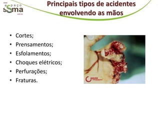 www.
                       Principais tipos de acidentes
           com.br          envolvendo as mãos

       •   Cortes;
       •   Prensamentos;
       •   Esfolamentos;
       •   Choques elétricos;
       •   Perfurações;
       •   Fraturas.
 