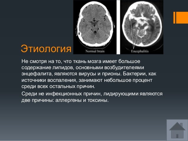 Моторная алалия энцефалопатия