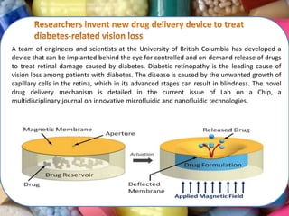 A team of engineers and scientists at the University of British Columbia has developed a
device that can be implanted behind the eye for controlled and on-demand release of drugs
to treat retinal damage caused by diabetes. Diabetic retinopathy is the leading cause of
vision loss among patients with diabetes. The disease is caused by the unwanted growth of
capillary cells in the retina, which in its advanced stages can result in blindness. The novel
drug delivery mechanism is detailed in the current issue of Lab on a Chip, a
multidisciplinary journal on innovative microfluidic and nanofluidic technologies.
 