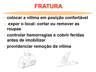 FRATURA
colocar a vítima em posição confortável
 expor o local: cortar ou remover as
roupas
controlar hemorragias e cobrir feridas
antes de imobilizar
providenciar remoção da vítima
 