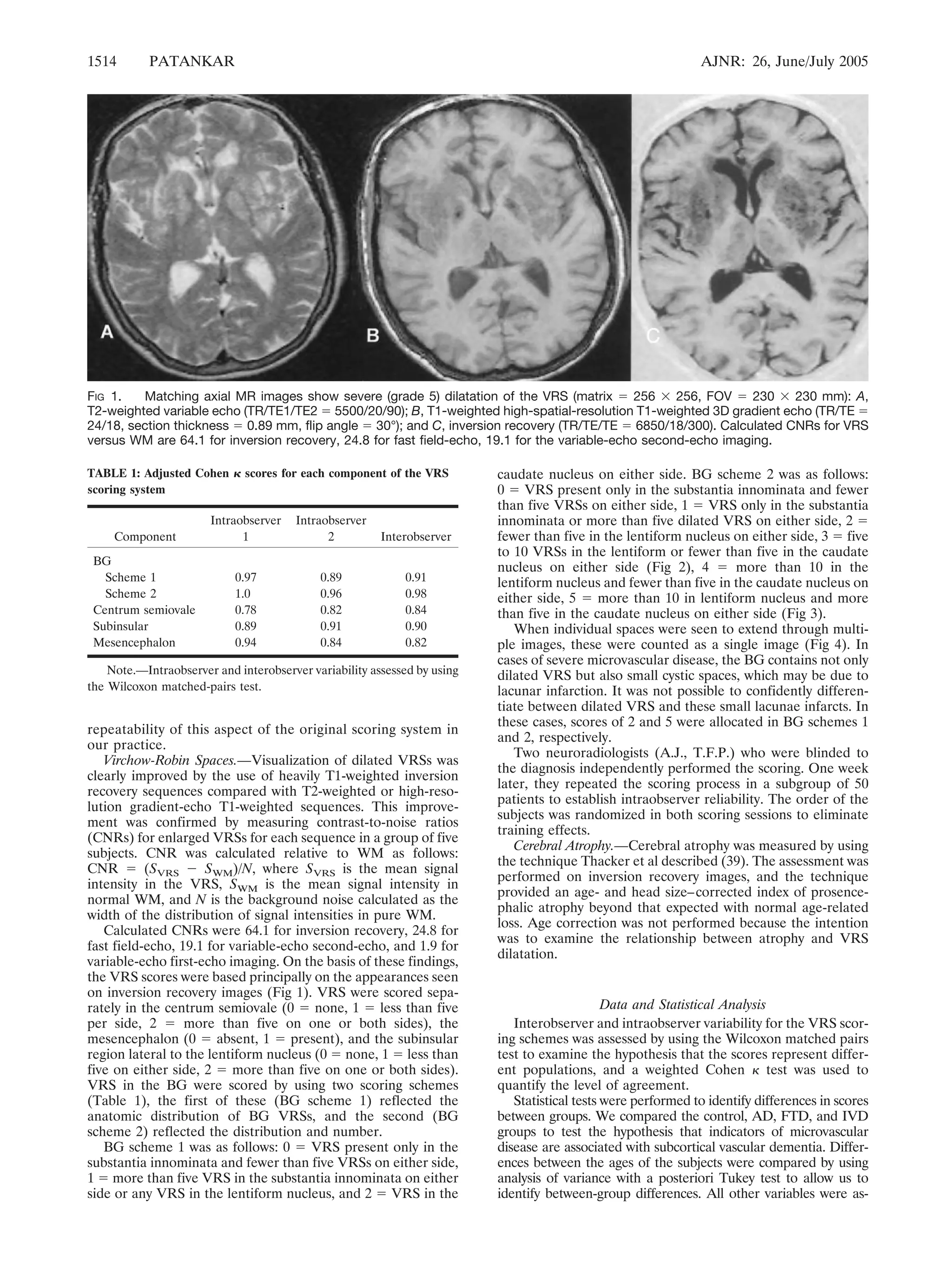 1514 PATANKAR AJNR: 26, June/July 2005 
FIG 1. Matching axial MR images show severe (grade 5) dilatation of the VRS (matrix  256  256, FOV  230  230 mm): A, 
T2-weighted variable echo (TR/TE1/TE2  5500/20/90); B, T1-weighted high-spatial-resolution T1-weighted 3D gradient echo (TR/TE  
24/18, section thickness  0.89 mm, flip angle  30°); and C, inversion recovery (TR/TE/TE  6850/18/300). Calculated CNRs for VRS 
versus WM are 64.1 for inversion recovery, 24.8 for fast field-echo, 19.1 for the variable-echo second-echo imaging. 
repeatability of this aspect of the original scoring system in 
our practice. 
Virchow-Robin Spaces.—Visualization of dilated VRSs was 
clearly improved by the use of heavily T1-weighted inversion 
recovery sequences compared with T2-weighted or high-reso-lution 
gradient-echo T1-weighted sequences. This improve-ment 
was confirmed by measuring contrast-to-noise ratios 
(CNRs) for enlarged VRSs for each sequence in a group of five 
subjects. CNR was calculated relative to WM as follows: 
CNR  (SVRS  SWM)/N, where SVRS is the mean signal 
intensity in the VRS, SWM is the mean signal intensity in 
normal WM, and N is the background noise calculated as the 
width of the distribution of signal intensities in pure WM. 
Calculated CNRs were 64.1 for inversion recovery, 24.8 for 
fast field-echo, 19.1 for variable-echo second-echo, and 1.9 for 
variable-echo first-echo imaging. On the basis of these findings, 
the VRS scores were based principally on the appearances seen 
on inversion recovery images (Fig 1). VRS were scored sepa-rately 
in the centrum semiovale (0  none, 1  less than five 
per side, 2  more than five on one or both sides), the 
mesencephalon (0  absent, 1  present), and the subinsular 
region lateral to the lentiform nucleus (0  none, 1  less than 
five on either side, 2  more than five on one or both sides). 
VRS in the BG were scored by using two scoring schemes 
(Table 1), the first of these (BG scheme 1) reflected the 
anatomic distribution of BG VRSs, and the second (BG 
scheme 2) reflected the distribution and number. 
BG scheme 1 was as follows: 0  VRS present only in the 
substantia innominata and fewer than five VRSs on either side, 
1  more than five VRS in the substantia innominata on either 
side or any VRS in the lentiform nucleus, and 2  VRS in the 
caudate nucleus on either side. BG scheme 2 was as follows: 
0  VRS present only in the substantia innominata and fewer 
than five VRSs on either side, 1  VRS only in the substantia 
innominata or more than five dilated VRS on either side, 2  
fewer than five in the lentiform nucleus on either side, 3  five 
to 10 VRSs in the lentiform or fewer than five in the caudate 
nucleus on either side (Fig 2), 4  more than 10 in the 
lentiform nucleus and fewer than five in the caudate nucleus on 
either side, 5  more than 10 in lentiform nucleus and more 
than five in the caudate nucleus on either side (Fig 3). 
When individual spaces were seen to extend through multi-ple 
images, these were counted as a single image (Fig 4). In 
cases of severe microvascular disease, the BG contains not only 
dilated VRS but also small cystic spaces, which may be due to 
lacunar infarction. It was not possible to confidently differen-tiate 
between dilated VRS and these small lacunae infarcts. In 
these cases, scores of 2 and 5 were allocated in BG schemes 1 
and 2, respectively. 
Two neuroradiologists (A.J., T.F.P.) who were blinded to 
the diagnosis independently performed the scoring. One week 
later, they repeated the scoring process in a subgroup of 50 
patients to establish intraobserver reliability. The order of the 
subjects was randomized in both scoring sessions to eliminate 
training effects. 
Cerebral Atrophy.—Cerebral atrophy was measured by using 
the technique Thacker et al described (39). The assessment was 
performed on inversion recovery images, and the technique 
provided an age- and head size– corrected index of prosence-phalic 
atrophy beyond that expected with normal age-related 
loss. Age correction was not performed because the intention 
was to examine the relationship between atrophy and VRS 
dilatation. 
Data and Statistical Analysis 
Interobserver and intraobserver variability for the VRS scor-ing 
schemes was assessed by using the Wilcoxon matched pairs 
test to examine the hypothesis that the scores represent differ-ent 
populations, and a weighted Cohen  test was used to 
quantify the level of agreement. 
Statistical tests were performed to identify differences in scores 
between groups. We compared the control, AD, FTD, and IVD 
groups to test the hypothesis that indicators of microvascular 
disease are associated with subcortical vascular dementia. Differ-ences 
between the ages of the subjects were compared by using 
analysis of variance with a posteriori Tukey test to allow us to 
identify between-group differences. All other variables were as- 
TABLE 1: Adjusted Cohen  scores for each component of the VRS 
scoring system 
Component 
Intraobserver 
1 
Intraobserver 
2 Interobserver 
BG 
Scheme 1 0.97 0.89 0.91 
Scheme 2 1.0 0.96 0.98 
Centrum semiovale 0.78 0.82 0.84 
Subinsular 0.89 0.91 0.90 
Mesencephalon 0.94 0.84 0.82 
Note.—Intraobserver and interobserver variability assessed by using 
the Wilcoxon matched-pairs test. 
 