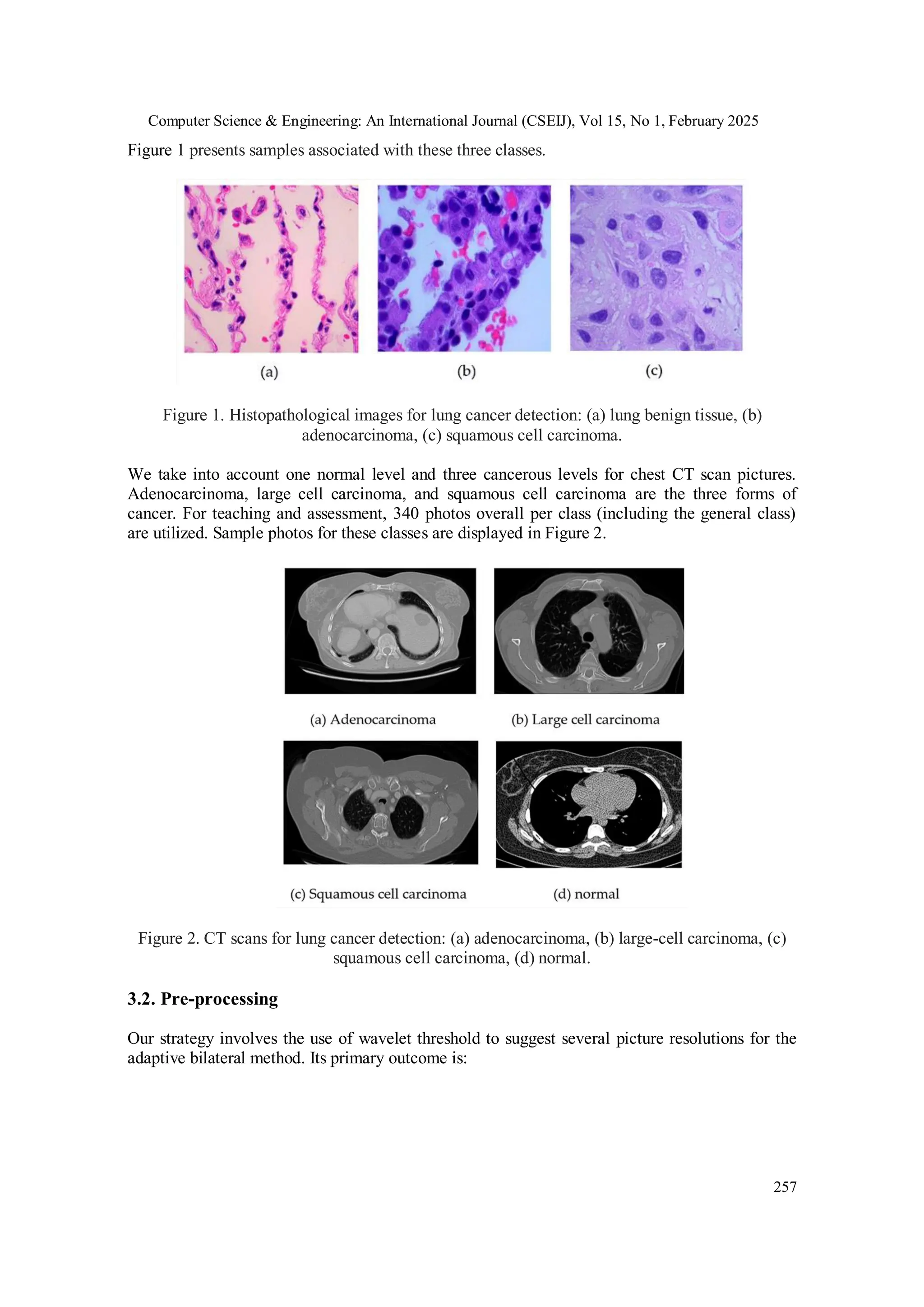 Computer Science & Engineering: An International Journal (CSEIJ), Vol 15, No 1, February 2025
257
Figure 1 presents samples associated with these three classes.
Figure 1. Histopathological images for lung cancer detection: (a) lung benign tissue, (b)
adenocarcinoma, (c) squamous cell carcinoma.
We take into account one normal level and three cancerous levels for chest CT scan pictures.
Adenocarcinoma, large cell carcinoma, and squamous cell carcinoma are the three forms of
cancer. For teaching and assessment, 340 photos overall per class (including the general class)
are utilized. Sample photos for these classes are displayed in Figure 2.
Figure 2. CT scans for lung cancer detection: (a) adenocarcinoma, (b) large-cell carcinoma, (c)
squamous cell carcinoma, (d) normal.
3.2. Pre-processing
Our strategy involves the use of wavelet threshold to suggest several picture resolutions for the
adaptive bilateral method. Its primary outcome is:
 