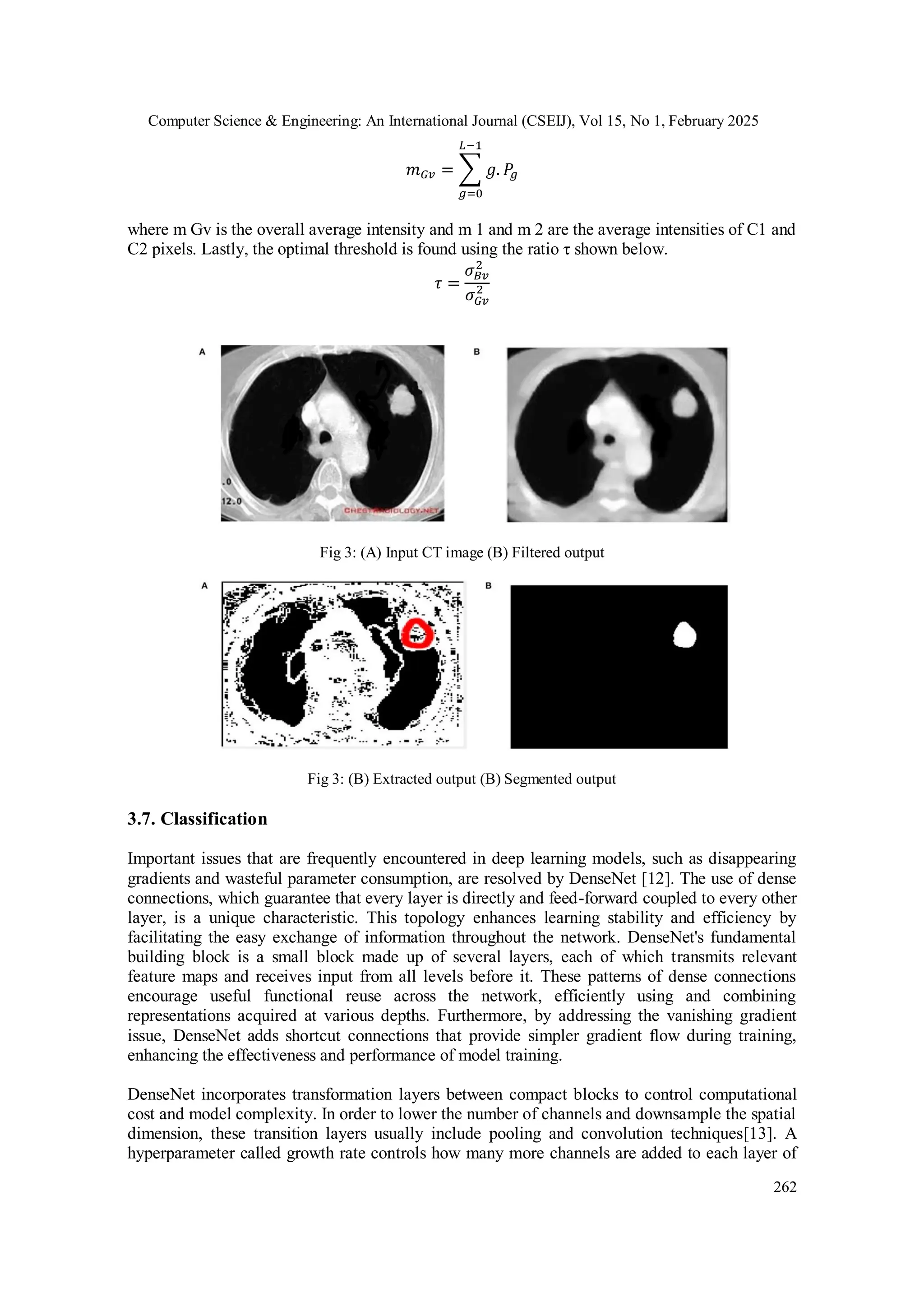 Computer Science & Engineering: An International Journal (CSEIJ), Vol 15, No 1, February 2025
262
𝑚𝐺𝑣 = ∑ 𝑔. 𝑃
𝑔
𝐿−1
𝑔=0
where m Gv is the overall average intensity and m 1 and m 2 are the average intensities of C1 and
C2 pixels. Lastly, the optimal threshold is found using the ratio τ shown below.
𝜏 =
𝜎𝐵𝑣
2
𝜎𝐺𝑣
2
Fig 3: (A) Input CT image (B) Filtered output
Fig 3: (B) Extracted output (B) Segmented output
3.7. Classification
Important issues that are frequently encountered in deep learning models, such as disappearing
gradients and wasteful parameter consumption, are resolved by DenseNet [12]. The use of dense
connections, which guarantee that every layer is directly and feed-forward coupled to every other
layer, is a unique characteristic. This topology enhances learning stability and efficiency by
facilitating the easy exchange of information throughout the network. DenseNet's fundamental
building block is a small block made up of several layers, each of which transmits relevant
feature maps and receives input from all levels before it. These patterns of dense connections
encourage useful functional reuse across the network, efficiently using and combining
representations acquired at various depths. Furthermore, by addressing the vanishing gradient
issue, DenseNet adds shortcut connections that provide simpler gradient flow during training,
enhancing the effectiveness and performance of model training.
DenseNet incorporates transformation layers between compact blocks to control computational
cost and model complexity. In order to lower the number of channels and downsample the spatial
dimension, these transition layers usually include pooling and convolution techniques[13]. A
hyperparameter called growth rate controls how many more channels are added to each layer of
 