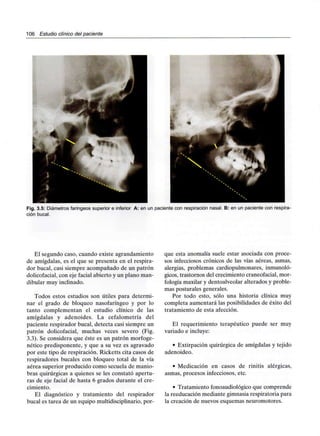 106 Estudio clínico del paciente
Fig. 3.5: Diámetros faríngeos superior e inferior A: en un paciente con respiración nasal. B: en un paciente con respira-
ción bucal.
El segundo caso, cuando existe agrandamiento
de amígdalas, es el que se presenta en el respira-
dor bucal, casi siempre acompañado de un patrón
dolicofacial, con eje facial abierto y un plano man-
dibular muy inclinado.
Todos estos estudios son útiles para determi-
nar el grado de bloqueo nasofaríngeo y por lo
tanto complementan el estudio clínico de las
amígdalas y adenoides. La cefalometría del
paciente respirador bucal, detecta casi siempre un
patrón dolicofacial, muchas veces severo (Fig.
3.3). Se considera que éste es un patrón morfoge-
nético predisponente, y que a su vez es agravado
por este tipo de respiración. Ricketts cita casos de
respiradores bucales con bloqueo total de la vía
aérea superior producido como secuela de manio-
bras quirúrgicas a quienes se les constató apertu-
ras de eje facial de hasta 6 grados durante el cre-
cimiento.
El diagnóstico y tratamiento del respirador
bucal es tarea de un equipo multidisciplinario, por-
que esta anomalía suele estar asociada con proce-
sos infecciosos crónicos de las vías aéreas, asmas,
alergias, problemas cardiopulmonares, inmunoló-
gicos, trastornos del crecimiento craneofacial, mor-
fología maxilar y dentoalveolar alterados y proble-
mas posturales generales.
Por todo esto, sólo una historia clínica muy
completa aumentará las posibilidades de éxito del
tratamiento de esta afección.
El requerimiento terapéutico puede ser muy
variado e incluye:
• Extirpación quirúrgica de amígdalas y tejido
adenoideo.
• Medicación en casos de rinitis alérgicas,
asmas, procesos infecciosos, etc.
• Tratamiento fonoaudiológico que comprende
la reeducación mediante gimnasia respiratoria para
la creación de nuevos esquemas neuromotores.
 