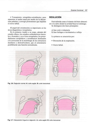 Examen funcional 107
• Tratamiento ortopédico-ortodóncico para
aumentar el ancho nasal por medio de la disyun-
ción palatina, y corregir protrusiones que impidan
el cierre labial.
El papel del ortodoncista es importante en las
áreas diagnóstica y terapéutica.
En la primera, tendrá a su cargo, además del
estudio clínico, los estudios cefalométricos latera-
les y frontales; y en el área terapéutica, los proce-
dimientos ortopédicos y ortodóncicos destinados
a la corrección de la morfología de las estructuras
maxilares y dentoalveolares, que al armonizarse
posibilitarán una función normalizada.
DEGLUCIÓN
Está definida como el tránsito del bolo alimenti-
cio o la saliva desde la cavidad bucal al estómago.
Se distinguen dos fases principales:
a) fase oral o voluntaria
b) fase faríngea o involuntaria o refleja
La primera se caracteriza por:
• Detención de la respiración.
• Cierre labial.
Fig. 3.6: Deglución normal. A: corte sagital. B: cortetransversal.
Fig. 3.7: Interposición lingual en deglución. A: corte sagital. B: cortetransversal.
 