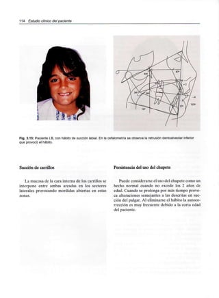 114 Estudio clínico del paciente
Fig. 3.15: Paciente LB, con hábito de succión labial. En la cefalometría se observa la retrusión dentoalveolarinferior
que provocó el hábito.
Succión de carrillos Persistencia del uso del chupete
La mucosa de la cara interna de los carrillos se
interpone entre ambas arcadas en los sectores
laterales provocando mordidas abiertas en estas
zonas.
Puede considerarse el uso del chupete como un
hecho normal cuando no excede los 2 años de
edad. Cuando se prolonga por más tiempo provo-
ca alteraciones semejantes a las descritas en suc-
ción del pulgar. Al eliminarse el hábito la autoco-
rrección es muy frecuente debido a la corta edad
del paciente.
 