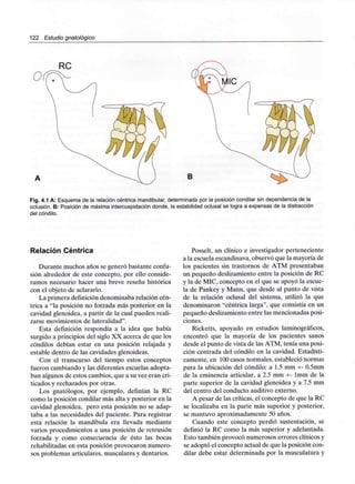122 Estudio gnatológico
B
Fig. 4.1 A: Esquema de la relación céntrica mandibular,determinada por la posición condilar sin dependenciade la
oclusión. B: Posición de máxima intercuspidación donde, la estabilidad oclusal se logra a expensas de ladistracción
del cóndilo.
Relación Céntrica
Durante muchos años se generó bastante confu-
sión alrededor de este concepto, por ello conside-
ramos necesario hacer una breve reseña histórica
con el objeto de aclararlo.
La primera definición denominaba relación cén-
trica a "la posición no forzada más posterior en la
cavidad glenoidea, a partir de la cual pueden reali-
zarse movimientos de lateralidad".
Esta definición respondía a la idea que había
surgido a principios del siglo XX acerca de que los
cóndilos debían estar en una posición relajada y
estable dentro de las cavidades glenoideas.
Con el transcurso del tiempo estos conceptos
fueron cambiando y las diferentes escuelas adopta-
ban algunos de estos cambios, que a su vez eran cri-
ticados y rechazados por otras.
Los gnatólogos, por ejemplo, definían la RC
como la posición condilar más alta y posterior en la
cavidad glenoidea, pero esta posición no se adap-
taba a las necesidades del paciente. Para registrar
esta relación la mandíbula era llevada mediante
varios procedimientos a una posición de retrusión
forzada y como consecuencia de ésto las bocas
rehabilitadas en esta posición provocaron numero-
sos problemas articulares, musculares y dentarios.
Posselt, un clínico e investigador perteneciente
a la escuela escandinava,observó que la mayoría de
los pacientes sin trastornos de ATM presentaban
un pequeño deslizamiento entre la posición de RC
y la de MIC, concepto en el que se apoyó la escue-
la de Pankey y Mann, que desde al punto de vista
de la relación oclusal del sistema, utilizó la que
denominaron "céntrica larga", que consistía en un
pequeño deslizamientoentre las mencionadas posi-
ciones.
Ricketts, apoyado en estudios laminográficos,
encontró que la mayoría de los pacientes sanos
desde el punto de vista de las ATM, tenía una posi-
ción centrada del cóndilo en la cavidad. Estadísti-
camente, en 100casos normales, estableció normas
para la ubicación del cóndilo: a 1.5 mm +- O.Smm
de la eminencia articular, a 2.5 mm +- Imm de la
parte superior de la cavidad glenoidea y a 7.5 mm
del centro del conducto auditivo externo.
A pesar de las críticas, el concepto de que la RC
se localizaba en la parte más superior y posterior,
se mantuvo aproximadamente 50 años.
Cuando este concepto perdió sustentación, se
definió la RC como la más superior y adelantada.
Esto también provocó numerosos errores clínicos y
se adoptó el concepto actual de que la posición con-
dilar debe estar determinada por la musculatura y
 