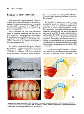 124 Estudio gnatológico
Objetivos funcionales oclusales
Con una concepción gnatológica del caso orto-
dóncico, uno de los objetivos es el correcto posicio-
namiento dentario con una oclusión en armonía
con la fisiología y la dinámica de las ATM, es decir,
una nueva oclusión que requiera una mínima adap-
tación neuromuscular.
Se hace necesario por ésto, tener información
sobre la dinámica mandibular del paciente, es
decir, reconocer y definir la postura adoptada por
la mandíbula como resultado de su máxima inter-
cuspidación para, mediante el tratamiento orto-
dóncico, ubicarla en una posición más estable y
favorable para su función.
Un paciente puede sufrir alteraciones oclusales
por distintas y variadas razones. Las erupciones
ectópicas, la pérdida de longitud de arcada, la
expresión de los hábitos y un sinfín de factores
crean alteraciones oclusales de diversa magnitud.
Sin olvidar también a la propia práctica odontoló-
gica como un posible factor generador de alteracio-
nes oclusales.
En definitiva el paciente que acude a nuestra
consulta ha tenido que adaptarse a su alteración
oclusal generando una reposición mandibular que
puede ser de mayor o menor magnitud. Esto se
hace mediante la participación del mecanismo pro-
pioceptivo neuromuscular que adapta la oclusión a
expensas de las ATM, llevando los cóndilos fuera
de la posición de RC. Por ejemplo, la presencia de
un contacto prematuro en el segmento posterior de
la oclusión puede actuar, inicialmente, como un ful-
crum y ser responsable de una inestabilidad orto-
pédica mandibular, con una distracción del cóndilo
en el momento de la máxima intercuspidación (Fig.
4.4 A y B).
Al estar fuera de su posición de RC, la mandí-
bula podrá estar con la musculatura contracturada,
será difícil de manipular y tendrá limitación en sus
,
U
B
Fig. 4.4 A: Montaje en articulador en RC. El contacto interoclusal se establece sólo a nivel de los segundos molares
que actúan como fulcrum para llegar a la PMI. B: en PMI se cierra la mordida, provocando la distracción del complejo
cóndilo-disco, como se observa en el gráfico de la derecha.
 