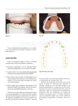 Placa de reposicionamiento mandibular 133
Fig. 5.7. Fig. 5.8.
Una vez logradas estas condiciones, se reempla-
za la cera por la resina acrílica mediante el enmu-
flado (Fig. 5.7).
ADAPTACIÓN
Una vez instalada la placa en boca, se deberá
constatar que reúna los siguientes requisitos:
• Contactos puntiformes de las cúspides funda-
mentales antagonistas en los sectores laterales.
• Acople incisivo con una separación que permita
el pasaje de un papel shimstock de 0,0005".
• Guía anterior que permita la desoclusión de los
sectores posteriores durante el movimiento pro-
trusivo, y en la cual deben participar los incisi-
vos y/o los caninos.
• Guías caninas que permitan la desoclusión en los
lados de trabajo y no trabajo, durante las excur-
siones de lateralidad izquierda y derecha.
El uso de esta placa debe ser permanente duran-
te la desprogramación. Se debe controlar periódi-
camente al paciente para reajustarla a los cambios
de posición mandibular que ocurran durante ese
período, procurando mantener siempre, o mejorar
' '
'
• !|
•
•
•
Fig. 5.9: Placa terminada.
si fuese posible, las condiciones iniciales de contac-
to y protección de las guías (Fig. 5.8).
Después de un período de tiempo, que variará
según el grado de alteración que presente el
paciente, cuando ya no se perciban cambios en la
posición mandibular y se compruebe su libre mani-
pulación, así como el control del paciente sobre los
diferentes tipos de movimientos mandibulares,
podremos estar en condiciones de realizar los
registros pertinentes para el montaje definitivo,
que nos permitirá realizar un correcto análisis de
las relaciones esqueléticas y dentarias del caso a
tratar.
 