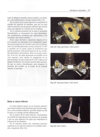 Montaje en articulador 137
tope de plástico amarillo (mesa incisal) o un vasta-
go o pin milimetrado (vastago incisal) (Fig. 6.3).
En el centro de la rama superior se encuentra el
tornillo de sujeción de platinas, que por su cara
inferior presenta dos pequeñas salientes que son las
guías que impiden la rotación de los modelos.
En el extremo posterior de la rama y colocados
lateralmente, se encuentran las cajas glenoideas,
dos semihesferas metálicas que representan a las
cavidades del mismo nombre.
Estas cajas derecha e izquierda (figuras 6.4 y
6.5), pueden ser ajustadas en su inclinación (torni-
llo posterosuperior de la base), para dar la inclina-
ción a la cavidad glenoidea en una escala de 5°a65°
y permitir así su ajuste según la inclinación que
pueda presentar cada pared anterior de las cavida-
des glenoideas del paciente. Ésta es la guía condi-
lea. A su vez, las cajas presentan un tornillo en su
cara superior, para ajustar la angulación de su
pared medial, en una escala de 0° a 35° y fijar así el
ángulo de Bennet. En la parte lateral, tiene una ani-
lla que se mueve lateralmente para asegurar la
posición del cóndilo en el fondo de la cavidad
durante el montaje.
Fig. 6.4: Cajas glenoideas.Vistasuperior.
Fig. 6.5: Cajas glenoideas.Vistainferior.
Base o rama inferior
La rama inferior posee en su extremo anterior
una ranura similar a las descritas para la rama supe-
rior y con el mismo objetivo: permitir alojar en ella
la mesa o el vastago incisal milimetrado.
En el centro de la rama inferior, encontramos
un tornillo de sujeción para las platinas de montaje
y por su cara superior los topes que impedirán la
rotación de los modelos.
En el extremo distal, dos columnas laterales
soportan en su extremo superior los cóndilos dere-
cho e izquierdo (Fig. 6.6).
Fig. 6.6: Ramainferior.
 
