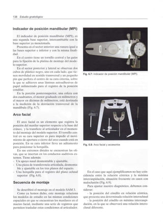 138 Estudio gnatológico
Indicador de posición mandibular (MPI)
El indicador de posición mandibular (MPI), es
una segunda base superior, intercambiable con la
base superior ya mencionada.
Presenta en el sector anterior una ranura igual a
las bases superior e inferior y con la misma finali-
dad.
En el centro tiene un tornillo central y las guías
para la fijación de la platina de montaje del mode-
lo superior.
En el sector posterior y lateral se observan dos
cubos de plástico negro, uno en cada lado, que tie-
nen movilidad en sentido transversal y un pequeño
pin que perfora el centro de su cara externa, sobre
la que se adhieren unas láminas autoadhesivas de
papel milimetrado para el registro de la posición
condilar.
En la porción posterosuperior, una esfera con
dos cuadrantes, el menor graduado en milímetros y
el mayor en décimas de milímetros, está destinada
a la medición de la desviación transversal de la
mandíbula (Fig. 6.7).
Arco facial
El arco facial es un elemento que registra la
posición del maxilar superior respecto a la base del
cráneo, y la transfiere al articulador en el momen-
to del montaje del modelo superior. El tornillo cen-
tral en su cara superior es para impedir el movi-
miento de apertura o cierre del arco cuando está en
posición. En su cara inferior lleva un aditamento
para posicionar la horquilla.
En sus extremos distales se encuentran las oli-
vas, que se insertan en los conductos auditivos ex-
ternos. Tiene además:
- Un apoyo nasal desmontable y ajustable.
- Una pieza de transferencia articulada, desmonta-
ble y ajustable en los tres planos del espacio.
- Una horquilla para el registro del plano oclusal
superior (Fig. 6.8).
Secuencia de montaje
Se describirá el montaje en el modelo SAM 3.
Como ya hemos dicho, este montaje relaciona
los modelos de estudio en las mismas condiciones
espaciales en que se encuentran los maxilares en el
macizo facial, mediante una serie de registros que
permiten trasladar estas condiciones al articulador.
Fig. 6.7: Indicador de posición mandibular (MPI).
Fig. 6.8: Arco facial y accesorios
En el caso que aquí ejemplificamos no hay coin-
cidencia entre la relación céntrica y la máxima
intercuspidación, situación frecuente en casos con
maloclusión (Fig. 6.9).
Para ajustar nuestro diagnóstico, debemos con-
siderar:
- la posición del cóndilo en relación céntrica,
que presenta una determinada relación interoclusal
- la posición del cóndilo en máxima intercuspi-
dación, en la que se observará una relación intero-
clusal diferente.
 
