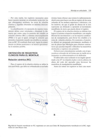 Montaje en articulador 139
Por esta razón, los registros necesarios para
hacer nuestro montaje en articulador serán dos: los
que obtengamos mediante las ceras de relación
céntrica y aquellas obtenidas en máxima intercus-
pidación.
La planificación y la ejecución de nuestro trata-
miento deben estar orientadas a disminuir la dis-
tancia que existe entre la posición del cóndilo en
relación céntrica (RC) y máxima intercuspidación
(PMI) o lo que es igual, corregir la oclusión que
presenta el paciente cuando sus cóndilos se encuen-
tran en RC. El resultado final será lograr la coinci-
dencia en dichas posiciones o al menos aproximar-
las lo máximo posible.
OBTENCIÓN DE REGISTROS
CLÍNICOS PARA EL MONTAJE
Relación céntrica (RC)
Para el registro de la relación céntrica se utiliza la
cera azulDelar, que debe ser reblandecida en un baño
térmico hasta obtener una textura lo suficientemente
dúctil como para hacer con ella un registro de las caras
oclusales de los molares superiores e inferiores y de
los incisivos, sin que el grado de dureza de la cera
represente un obstáculo u oposición al movimiento
mandibular de cierre que pueda alterar el registro.
El registro de la relación céntrica se obtiene tras
lograr la máxima relajación mandibular, con amplia
libertad de movimientos y en las mejores condicio-
nes de manipulación, para llevar los cóndilos a la
zona de relación céntrica. En ocasiones, el pacien-
te deberá ser preparado previamente mediante el
uso de placas tipo Michigan para eliminar contrac-
turas que puedan impedir o dificultarlas maniobras
destinadas a registrar esta posición.
Deberá estar cómodamente sentado, con el apo-
yacabeza colocado de tal forma que su cuello no se
encuentre en sobreextensión ni en deflexión.
El sillón debe estar reclinado en un ángulo aproxi-
mado a los 45° en relación al piso y con la cabeza a la
altura del codo del operador para favorecer las
maniobras de manipulación mandibular.
Antes de tomar los registros se hace una mani-
Fig. 6.9. A: Posición mandibular en RC; registrada con cera azul Delar. B: Desplazamientomandibular en la MIC, regis-
trada con cera Moyco rosa.
 