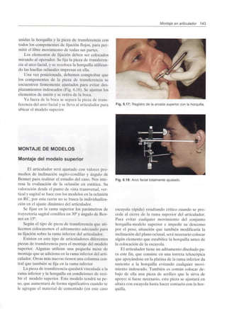 Montaje en articulador 143
unidas la horquilla y la pieza de transferencia con
todos los componentes de fijación flojos, para per-
mitir el libre movimiento de todas sus partes.
Los elementos de fijación deben ser colocados
mirando al operador. Se fija la pieza de transferen-
cia al arco facial, y se recoloca la horquilla utilizan-
do las huellas oclusales impresas en ella.
Una vez posicionada, debemos comprobar que
los componentes de la pieza de transferencia se
encuentren firmemente ajustados para evitar des-
plazamientos indeseados (Fig. 6.18). Se ajustan los
elementos de unión y se retira de la boca.
Ya fuera de la boca se separa la pieza de trans-
ferencia del arco facial y se lleva al articulador para
ubicar el modelo superior.
MONTAJE DE MODELOS
Montaje del modelo superior
El articulador será ajustado con valores pro-
medios de inclinación sagito-condilar y ángulo de
Bennet para realizar el estudio del caso. Nos inte-
resa la evaluación de la oclusión en estática. Su
valoración desde el punto de vista transversal, ver-
tical y sagital se hace con los modelos en la oclusión
en RC, por esta razón no se busca laindividualiza-
ción en el ajuste dinámico del articulador.
Se fijan en la rama superior los parámetros de
trayectoria sagital condílea en 30°y ángulo de Ben-
net en 15°.
Según el tipo de pieza de transferencia que uti-
licemos colocaremos el aditamento adecuado para
su fijación sobre la rama inferior del articulador.
Existen en este tipo de articuladores diferentes
piezas de transferencia para el montaje del modelo
superior. Algunas utilizan una pequeña mesa de
montaje que se adiciona en la rama inferior del arti-
culador. Otras más nuevas tienen una columna cen-
tral que también se fija en la rama inferior
La pieza de transferencia quedará vinculada a la
rama inferior y la horquilla en condiciones de reci-
bir el modelo superior. Este modelo tendrá su pe-
so, que aumentará de forma significativa cuando se
le agregue el material de cementado (en este caso
Fig. 6.17: Registro de la arcada superior con la horquilla.
Fig. 6.18: Arco facial totalmenteajustado.
escayola rápida) resultando crítico cuando se pro-
cede al cierre de la rama superior del articulador.
Para evitar cualquier movimiento del conjunto
horquilla-modelo superior e impedir su descenso
por el peso, situación que también modificaría la
inclinación del plano oclusal, será necesario colocar
algún elemento que estabilice la horquilla antes de
la colocación de la escayola.
El articulador tiene un aditamento diseñado pa-
ra este fin, que consiste en una torreta telescópica
que apoyándose en la platina de la rama inferior da
sustento a la horquilla evitando cualquier movi-
miento indeseado. También es común colocar de-
bajo de ella una pieza de acrílico que le sirva de
apoyo; si fuese necesario, esta pieza se ajustará en
altura con escayola hasta hacer contacto con la hor-
quilla.
 