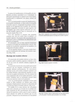 144 Estudio gnatológico
La pieza de transferencia y la horquilla así esta-
bilizada permiten reproducir en el articulador la
ubicación espacial que se registró con el arco facial,
transfiriendo la inclinación del plano oclusal del
paciente.
Una vez posicionada la pieza de transferenciay
la horquilla estabilizada, se ubica sobre la horquilla
el modelo superior, asegurando un perfecto asenta-
miento en la impronta de la godiva. El operador
deberá comprobar, cerrando la rama superior del
articulador, que exista espacio suficiente por enci-
ma del modelo superior para la colocación de la
escayola rápida (Fig. 6.19).
Con este material se prepara una pequeña
columna que sirva de unión entre la platina y el
modelo superior. Se prepara sólo una pequeña can-
tidad para evitar (o minimizar) las distorsiones que
provoca su fraguado.
El articulador con su rama superior horizontal
al apoyar en la pieza de transferencia, evita la dis-
torsión de la posición espacial de los modelos y la
inclinación del plano oclusal.
En un segundo tiempo y con yeso común hace-
mos la terminación del montaje del modelo supe-
rior (Fig. 6.20).
Montaje del modelo inferior
El cementado del modelo inferior se hace rela-
cionando ambos modelos, superior e inferior, a tra-
vés de las ceras de relación céntrica (registro de
cera azul).
Es necesario recortar las ceras azules para poder
observar que las cúspides vestibulares de ambas
arcadas asienten perfectamente. Es conveniente
eliminar en las ceras azules cualquier contacto con
los tejidos blandos, especialmente aquellos en rela-
ción con la papila retroincisiva. De esta manera las
ceras adaptarán sólo en los tejidos dentarios, y para
poder visualizar ésto se recortarán excesos tanto
en la cera anterior como en la posterior.
Una vez perfectamente asentados en las ceras
azules se fijan mediante un elástico para evitar
cualquier desplazamiento durante la colocación del
material que fijará el modelo inferior. (Fig. 6.21)
El cóndilo de la rama inferior del articulador
debe estar colocado en el fondo de la cavidad arti-
cular (posición de RC) permitiendo sólo el movi-
miento de apertura y cierre, para lo cual se ajustan
hacia adentro las anillas de céntrica que en esta
posición bloquean los movimientos de lateralidad
Fig. 6.19: Instalación de la pieza de transferencia con la
horquilla estabilizada para el montaje del modelo superior.
Fig. 6.20: Modelo superior montado.
Fig. 6.21: Modelo inferior relacionadocon las ceras de RC
y el articulador invertido para procedera su montaje.
 
