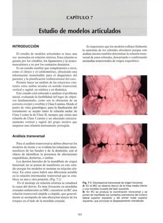 CAPITULO 7
Estudio de modelos articulados
INTRODUCCIÓN
El estudio de modelos articulados se hace una
vez montados en relación céntrica. Esta relación es
guiada por los cóndilos, los ligamentos y la neuro-
musculatura y no por los contactos dentarios.
Es un estudio auxiliar que complementa a otros,
como el clínico y el cefalométrico, ofreciendo una
información insustituible para el diagnóstico del
paciente y la planificación tridimensional del caso.
Permite hacer un análisis de las relaciones exis-
tentes entre ambas arcadas en sentido transversal,
vertical y sagital, en estática y en dinámica.
Este estudio está enfocado a analizar el problema
inicial, evaluando la factibilidad del logro de objeti-
vos fundamentales, como son la obtención de un
correcto overjet y overbite y Clase I canina. Desde el
punto de vista gnatológico, para la finalización del
tratamiento se acepta tanto la relación molar de
Clase I como la de Clase II, siempre que exista una
relación de Clase I canina y un adecuado entrecru-
zamiento vertical y sagital del grupo incisivo que
aseguren una oclusión mutuamente protegida.
Análisis transversal
Para el análisis transversal se deben observar los
modelos de frente y se evalúan las relaciones inter-
maxilares de las básales y de la dentición, con el
objeto de identificar la presencia de alteraciones
esqueléticas, dentarias, o ambas.
Los desvíos laterales de la mandíbula de origen
funcional, no se ponen de manifiesto en este estu-
dio porque los modelos se montan en relación cén-
trica. En estos casos habrá una diferencia notable
en la relación intermaxilar transversal que se esta-
blece en una y otra posición. (Fig. 7.1)
En el montaje en relación céntrica se estudiará
la causa del desvío. Es muy frecuente en mordidas
cruzadas unilaterales en MIC, encontrar en RC una
relación transversal cúspide a cúspide, que general-
mente se acompaña de una alteración mayor de los
torques en el lado de la mordida cruzada.
Es importante que los modelos reflejen fielmente
la anatomía de los rebordes alveolares porque este
análisis intenta también determinar la relación trans-
versal de estos rebordes, descartando o confirmando
anomalías transversales de origen esquelético.
Fig. 7.1: Discrepancia transversal de origen funcional.
A: En la MIC se observa desvío de la línea media inferior
y una mordida cruzada del lado izquierdo.
B: En RC se produce la coordinación transversal y se
ponen de manifiesto los contactos prematuros del incisivo
lateral superior izquierdo y del primer molar superior
izquierdo, que provocan el desplazamiento mandibular.
151
 