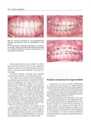 154 Estudio gnatológico
Fig. 7.5: Asimetría esqueletal. A: Las compensaciones
dentarias transversales evitan su manifestación a nivel
oclusal.
B: La aparatologfa totalmente programada, al normalizar
los torques, logrará la expresión del problema transversal
en la relación interdentaria, requisito indispensable en la
preparación prequirúrgica.
En la mayoría de los casos se observa un desfa-
saje transversal bilateral entre la base esqueletal
superior e inferior. En una hemiarcada, la basal in-
ferior se encuentra hacia vestibular, en la otra, ha-
cia lingual.
Es menos frecuente encontrar una asimetría
esqueletal que involucra a una sola hemiarcada.
En ambos casos, pueden existir compensacio-
nes dentarias que enmascaran el problema, dificul-
tando su diagnóstico, por lo que deben ser cuida-
dosamente evaluados los torques de los sectores
laterales (Fig. 7.3 B). Por ejemplo, la presencia de
torques anormales y de sentido opuesto del lado
derecho e izquierdo en un paciente que tiene una
relación transversal normal entre la arcada supe-
rior e inferior, puede ser un indicio de este tipo de
compensaciones (Fig. 7.4). Este tipo de torques
compensatorios es una contraindicación para el uso
de aparatología totalmente programada en aque-
llos casos en que no se planifique una solución qui-
rúrgica del problema transversal (Fig. 7.5).
En los casos de asimetría, este estudio de los
modelos montados será sólo una parte de los que se
deberán realizar para llegar a un correcto diagnós-
tico, complementándose siempre con el estudio clí-
nico, radiográfico, y fundamentalmente con la cefa-
lometría frontal que también se realiza en RC.
Problema transversal de origen dentario
A diferencia de lo que se estima comúnmente,
las alteraciones transversales de origen dentario
son menos frecuentes que las de origen esquelético.
Los problemas transversales de origen dentario
son aquellos en los que está comprometida la rela-
ción dentaria pero con bases esqueletales compati-
bles transversalmente (Fig 7.6 y 7.7).
Son provocados por una alteración en la posi-
ción de las piezas dentarias y esta malposición afec-
ta el torque de las piezas comprometidas. En con-
diciones normales la arcada inferior presenta un
torque negativo que progresa hacia distal. En la
arcada superior, el torque también es negativo pero
de menor grado. Esta condición se debe respetar y
es una limitación a la hora de hacer expansiones
con la intención de corregir una anomalía transver-
sal dentaria.
 