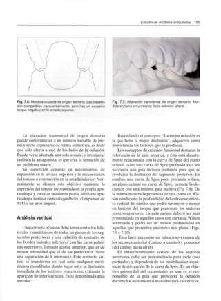 Estudio de modelos articulados 155
Fig. 7.6: Mordida cruzada de origen dentario. Lasbásales
son compatibles transversalmente,pero hay un excesivo
torque negativo en la arcada superior.
Fig. 7.7: Alteración transversal de origen dentario. Mor-
dida en tijera en un sector de la oclusiónlateral.
La alteración transversal de origen dentario
puede comprometer a un número variable de pie-
zas y suele expresarse de forma asimétrica, es decir
que sólo afecta a uno de los lados de la oclusión.
Puede verse afectada una sola arcada, o involucrar
también la antagonista, lo que crea la sensación de
un problema mayor.
Su corrección consiste en movimientos de
expansión en la arcada superior y la recuperación
del torque o contracción en la arcada inferior. Nor-
malmente se alcanza este objetivo mediante la
expresión del torque incorporada en la propia apa-
ratología y en otras ocasiones puede utilizarse apa-
ratología auxiliarcomo el quadhelix,el expansor de
NiTi o un arco lingual.
Análisis vertical
Una correcta oclusión debe tener contactos bila-
terales y simultáneos de todas las piezas de los seg-
mentos posteriores y una relación de contacto de
los bordes incisales inferiores con las caras palati-
nas superiores, llamado acople anterior, que es de
menor intensidad que el de los posteriores (tiene
una separación de 8 micrones). Este contacto vir-
tual se transforma en real ante cualquier movi-
miento mandibular dando lugar así a la disclusión
inmediata de los sectores posteriores, evitando la
aparición de interferencias. Es la denominada guía
anterior.
Recordando el concepto: "La mejor oclusión es
la que tiene la mejor disclusión", adquieren suma
importancia los factores que la producen.
Los conceptos de oclusión funcional destacan la
relevancia de la guía anterior, y ésta está directa-
mente relacionada con la curva de Spee del plano
oclusal. Ante una curva de Spee profunda va a ser
necesaria una guía incisiva profunda para que se
produzca la disclusión del segmento posterior. En
cambio, una curva de Spee poco profunda o bien,
un plano oclusal sin curva de Spee, permite la dis-
clusión con una mínima guía incisiva (Fig 7.8). De
la misma manera la presencia de una curva de Wil-
son condiciona la profundidaddel entrecruzamien-
to vertical del canino, que podrá ser mayor o menor
en función del torque que presenten los sectores
posterosuperiores. La guía canina deberá ser más
pronunciada en aquellos casos con curva de Wilson
acentuada y podrá ser de menor profundidad en
aquellos que presenten una curva más plana. (Figs.
7.9 y 7.10)
Esto hace necesario un minucioso examen de
los sectores anterior (canino a canino) y posterior
(del canino hacia atrás).
El entrecruzamiento vertical de los sectores
anteriores debe ser personalizado para cada caso
particular, y dependerá de las posibilidades mecá-
nicas de corrección de la curva de Spee. Es un obje-
tivo primordial del tratamiento ya que es el res-
ponsable de la guía que protegerá la oclusión
durante los movimientos mandibulares excéntricos.
 