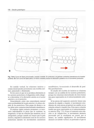 156 Estudio gnatológico
B
Fig. 7.8 A: Curva de Spee pronunciada y escaso overbite. En protrusiva, se generan contactos prematurosen el sector
posterior. B: Con curva de Spee plana, el mismo overbite produce la disclusión posterioren el movimiento protrusivo.
En sentido vertical, las relaciones incisivas y
canina inicial pueden presentarse con overbite nor-
mal, aumentado o disminuido.
En los casos en que no se produzca disclusión en
los sectores posteriores el diagnóstico debe dirigir-
se a determinar si la alteración asienta en el sector
anterior o en el posterior.
Generalmente existe una concordancia natural
entre profundidad de la guía anterior y la altura cús-
pide de los posteriores. Este grupo de dientes a su
vez debe tener contactos Ínteroclusales simultáneos.
Si existiese algún contacto prematuro, es nece-
sario individualizar la pieza que lo ocasiona, su
magnitud y el tipo de relación que mantiene con el
antagonista, porque cuando sea mayor que la guía
incisiva, impedirá la disclusión total de los sectores
posteriores durante los movimientos excéntricos
mandibulares, favoreciendo el desarrollo de posi-
bles parafunciones.
El estudio del overbite de incisivos se relaciona
siempre con un análisis de los sectores posteriores,
porque las relaciones interoclusales de éstos tienen
una gran repercusión en el entrecruzamiento ante-
rior.
Si las piezas del segmento posterior tienen una
relación de cúspide a cúspide, el movimiento orto-
dóncico de estas piezas propiciará un cambio en su
relación oclusal a cúspide-fosa. Esta nueva relación
tendrá una gran repercusión en el entrecruzamien-
to anterior (Fig. 7.11). Si por el contrario esta rela-
ción es de cúspide-fosa, el movimiento dentario
provocado por la ortodoncia no creará, por si
mismo, un cambio significativo. El movimiento
dentario en sentido vertical, en particular el que se
 