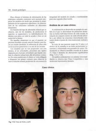 160 Estudio gnatológico
Para obtener el máximo de información de las
relaciones oclusales existentes será necesario pre-
parar los modelos de modo que permitan la mani-
pulación de los segmentos superiores y la observa-
ción de las relaciones oclusales en diferentes
situaciones.
En función del tipo de alteración oclusal que se
observe, uno de los modelos, de preferencia el
superior, se segmentará y se individualizarán los
dientes con pines en toda la arcada o bien en un
sector de la misma.
En aquellas situaciones en que el paciente no
presenta mordida cruzada anterior bastará, para ha-
cer un estudio detallado, la utilización de pines sólo
en los sectores posteriores y en una de las arcadas.
Los modelos que no son preparados con esta
técnica, al ser articulados, presentan una rigidez
impuesta por el propio articulador que impide ana-
lizar la relación oclusal más allá del primer contac-
to. En estas condiciones el clínico se vería obligado
a desgastar ese primer contacto para observar la
nueva relación oclusal, perdiendo de esta manera la
integridad del modelo de estudio e inutilizándolo
para una segunda observación.
Análisis de un caso clínico.
A continuación se desarrolla un ejemplo de aná-
lisis en el que se determinan las posiciones denta-
rias en forma individual dentro de cada arcada, su
relación de conjunto dentro de cada reborde alveo-
lar y por último las relaciones interoclusales exis-
tentes desde el punto de vista transversal, vertical y
sagital.
Se trata de una paciente mujer de 15 años y el
motivo de la consulta es un dolor periarticular re-
currente y relacionado con periodos de estrés. Clí-
nicamente se observa mordida cruzada de la pieza
17, Clase I dentaria sin alteraciones significativas
(Figs. 7.15 y 7.16).
Al análisis cefalométrico en máxima intercuspi-
dación se observa una Clase I esquelética y una
moderada biprotrusión dentaria.
Caso clínico
Fig. 7.15: Fotos de frente y perfil.
 