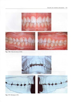 Estudio de modelos articulados 161
Fig. 7.16: Fotos de boca en MIC.
Fig. 7.17: Montaje en RC.
..
 