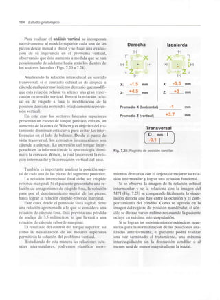 164 Estudio gnatológico
Para realizar el análisis vertical se incorporan
sucesivamente al modelo superior cada una de las
piezas desde mesial a distal y se hace una evalua-
ción de su ingerencia en el problema vertical,
observando que éste aumenta a medida que se van
posicionando de adelante hacia atrás los dientes de
los sectores laterales (Figs. 7.20 a 7.24).
Analizando la relación interoclusal en sentido
transversal, si el contacto oclusal es de cúspide a
cúspide cualquier movimiento dentario que modifi-
que esta relación oclusal va a tener una gran reper-
cusión en sentido vertical. Pero si la relación oclu-
sal es de cúspide a fosa la modificación de la
posición dentaria no tendrá prácticamente repercu-
sión vertical.
En este caso los sectores laterales superiores
presentan un exceso de torque positivo, esto es, un
aumento de la curva de Wilson y es objetivo del tra-
tamiento disminuir esta curva para evitar las inter-
ferencias en el lado de balance. Desde el punto de
vista transversal, los contactos intermaxilares son
cúspide a cúspide. La expresión del torque incor-
porado en la información de la aparatología dismi-
nuirá la curva de Wilson, lo cual favorecerá la rela-
ción intermaxilar y la corrección vertical del caso.
También es importante analizar la posición sagi-
tal de cada una de las piezas del segmento posterior.
La relación interoclusal final debe ser cúspide
reborde marginal. Si el paciente presentaba una re-
lación de antagonismo de cúspide-fosa,la solución
pasa por el desplazamiento sagital de las piezas,
hasta lograr la relación cúspide-reborde marginal.
Este caso, desde el punto de vista sagital, tiene
una relación aproximada a lo que se considera una
relación de cúspide-fosa. Está prevista una pérdida
de anclaje de 3.5 milímetros, lo que llevará a una
relación de cúspide reborde marginal.
El resultado del control del torque superior, así
como la mesialización de los molares superares
permitirán la solución del problema vertical.
Estudiando de esta manera las relaciones oclu-
sales intermaxilares, podremos planificar movi-
Derecha Izquierda
L
(+)
X: -1.5 mm
Z: *45
Promedio X(horizontal) -1
mm
mm
Promedio Z (vertical) mm
Transversal
Fig. 7.25: Registro de posición condilar.
mientes dentarios con el objeto de mejorar su rela-
ción intermaxilar y lograr una oclusión funcional.
Si se observa la imagen de la relación oclusal
intermaxilar y se la relaciona con la imagen del
MPT (Fig. 7.25) se comprende fácilmente la vincu-
lación directa que hay entre la oclusión y el com-
portamiento del cóndilo. Como se aprecia en la
imagen del registro de posición mandibular, el cón-
dilo se distrae varios milímetros cuando la paciente
ocluye en máxima intercuspidación.
Si se logran los movimientos ortodóncicos nece-
sarios para la normalización de las posiciones ana-
lizadas anteriormente, el paciente podrá realizar
una vez terminado el tratamiento, una máxima
intercuspidación sin la distracción condilar o al
menos será de menor magnitud que la inicial.
 