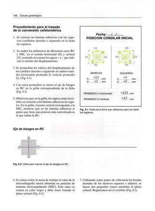 166 Estudio gnatológico
Procedimiento para el trazado
de la conversión cefalométrica
1. Se colocan las láminas adhesivas con los regis-
tros condilares derecho e izquierdo en la ficha
de registros.
2. Se miden los milímetros de diferencia entre RC
y MIC, en el sentido horizontal (X) y vertical
(Z), teniendo en cuenta lossignos+ y- queindi-
can el sentido del desplazamiento.
3. Se promedian los valores del desplazamiento de
los cóndilos derecho e izquierdo en ambos senti-
dos (horizontal: promedio X, vertical: promedio
Z), (Fig. 8.1).
4. Con estos promedios se marca el eje de bisagra
en RC en la grilla correspondiente de la ficha
(Fig. 8.2).
5. Obsérvese que en la grilla, los signos están inver-
tidos en relación a las láminas adhesivasde regis-
tro. En la grilla, el punto central corresponde a la
MIC, mientras que en las láminas adhesivas el
punto que tiene una posición más centralizadaes
el que indica la RC.
Fecha:..../..../.
POSICIÓN CONDILAR INICIAL
......
Z: ........ +.3 mm
IZQUIERDA
+3
X:
Z: +2
mm
mm
PROMEDIO X (Horizontal): +3,25. mm
PROMEDIO Z (Vertical): +2,5 mm
Fig. 8.1: Parte de la ficha que utilizamos para los distin-
tos registros.
Eje de bisagra en RC
©
©
Fig. 8.2: Grilla para marcar el eje de bisagra en RC.
6. Se coloca sobre la mesa de trabajo el calco de la
telerradiografía inicial obtenida en posición de
máxima intercuspidación (MIC). Este calco se
realiza en color negro y debe tener trazado el
plano oclusal (Fig. 8.3).
7. Utilizando como punto de referencia los bordes
incisales de los incisivos superior e inferior, se
hacen dos pequeños trazos paralelos al plano
oclusal. Registramos así el overbite (Fig. 8.3).
 